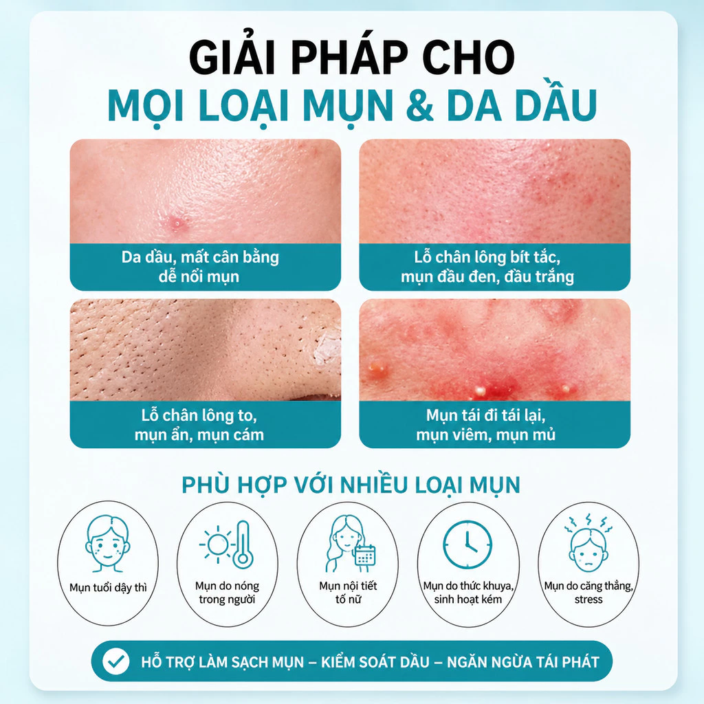 Kem Chấm Mụn Skinoren Cream Acid Azelaic 20% Giảm Mụn Mờ Thâm 30g