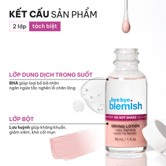 Dung Dịch Chấm Mụn Bye Bye Blemish Lotion 30ml