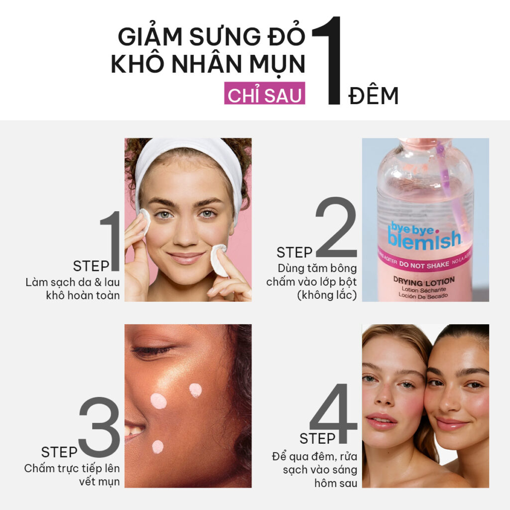 Dung Dịch Chấm Mụn Bye Bye Blemish Lotion 30ml