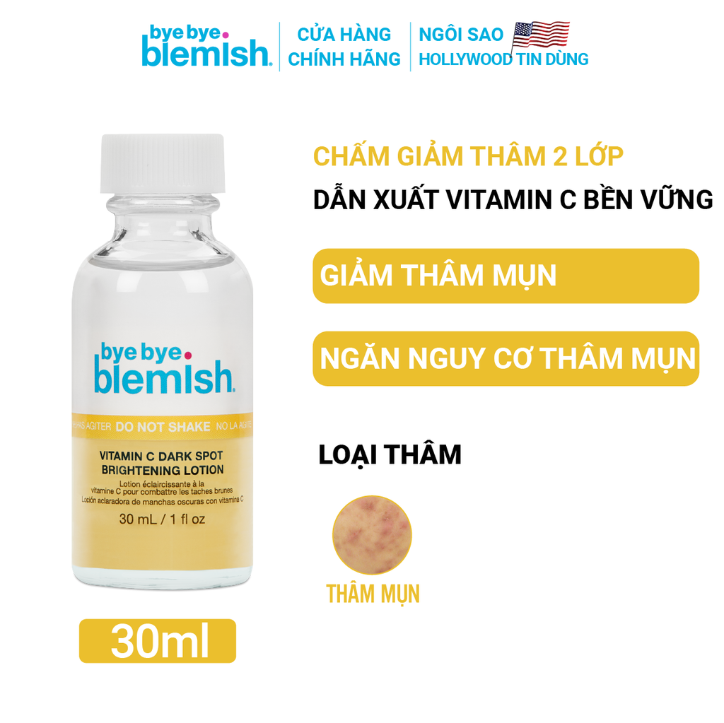 Dung Dịch Chấm Mụn Bye Bye Blemish Lotion 30ml
