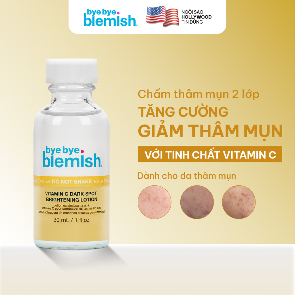 Dung Dịch Chấm Mụn Bye Bye Blemish Lotion 30ml