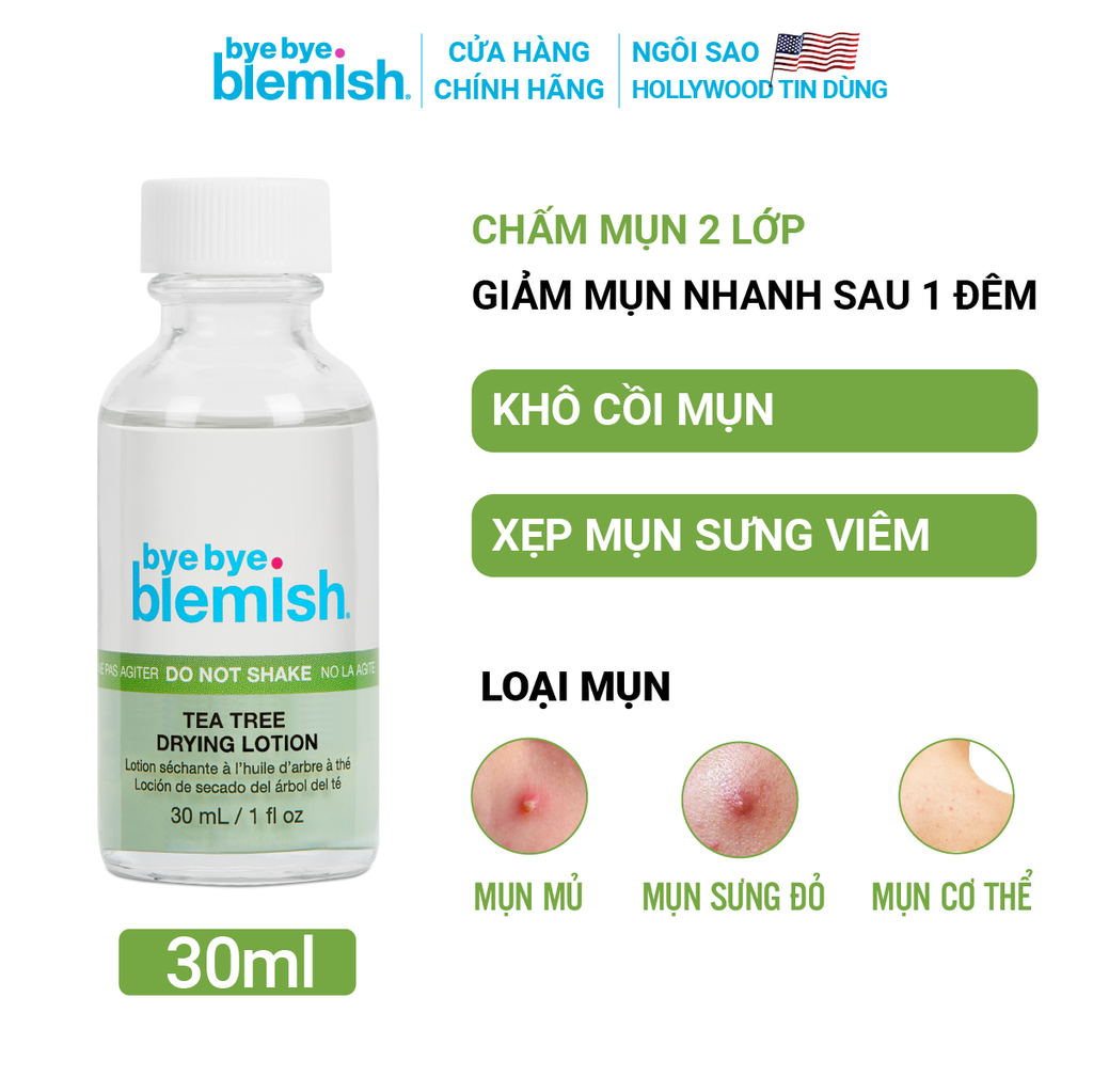 Dung Dịch Chấm Mụn Bye Bye Blemish Lotion 30ml