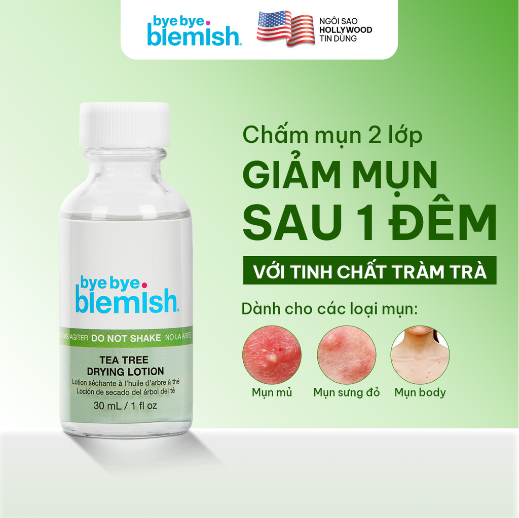 Dung Dịch Chấm Mụn Bye Bye Blemish Lotion 30ml