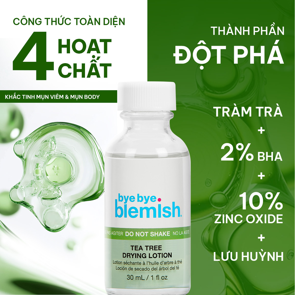 Dung Dịch Chấm Mụn Bye Bye Blemish Lotion 30ml