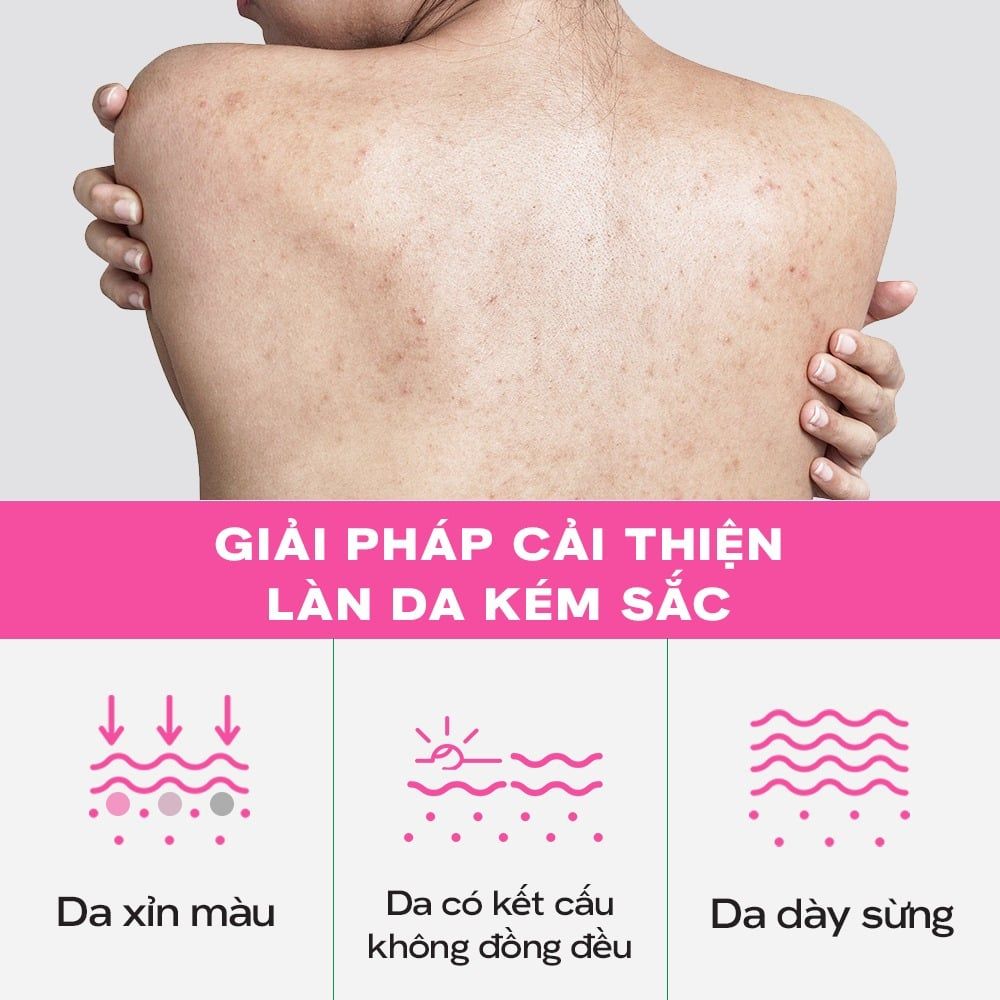 Tinh Chất Dưỡng Thể Skinoxy Concentrate Body Serum Dưỡng Sáng Đều Màu Da 275gr