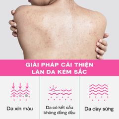 Tinh Chất Dưỡng Thể Skinoxy Concentrate Body Serum Dưỡng Sáng Đều Màu Da 275gr