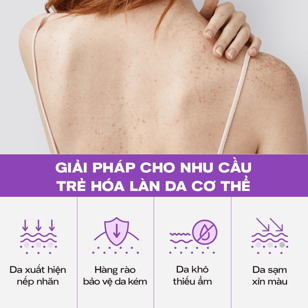 Tinh Chất Dưỡng Thể Skinoxy Concentrate Body Serum Dưỡng Sáng Đều Màu Da 275gr