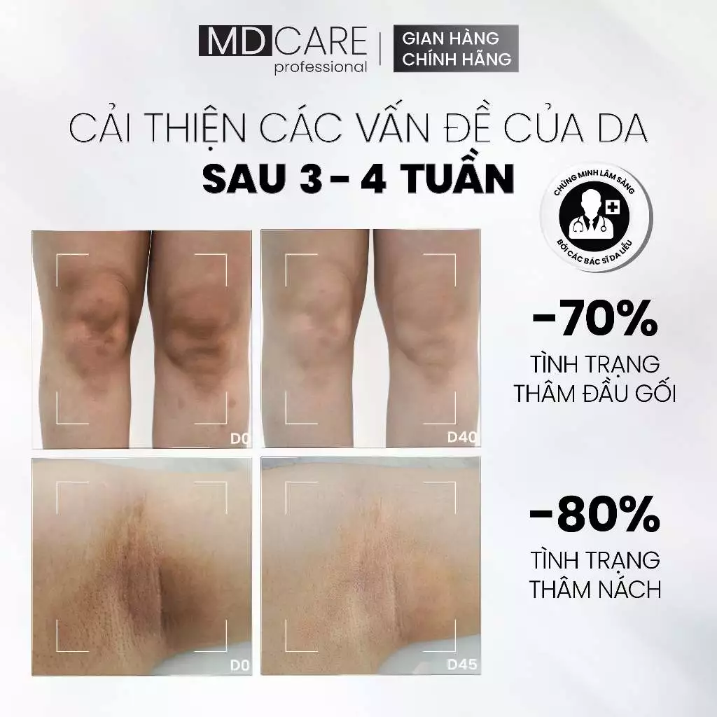 Sữa Dưỡng Thể MD Care Brightening Booster Body Lotion Sáng Da, Mờ Thâm 200ml