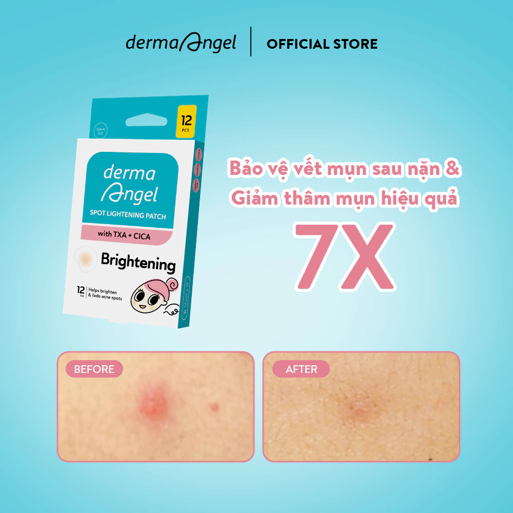 Miếng Dán Mụn Derma Angel Spot Lightening Patch Mờ Thâm Sáng Da 12 Miếng