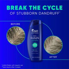 Dầu Gội Xả Trị Gàu Head & Shoulders 2 In 1 Clinical Strength Giảm Ngứa Chuyên Sâu 400ml