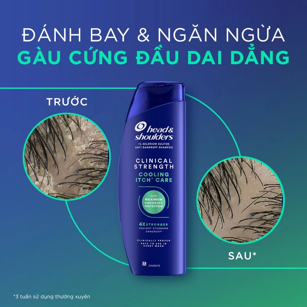 Dầu Gội Trị Gàu Head & Shoulders Clinical Strength Shampoo 400ml