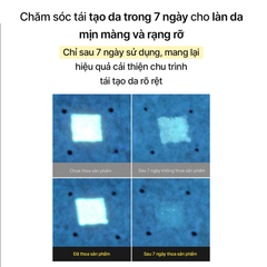 Tinh Chất Celimax Vita A Retinal Shot Tightening Booster Chống Lão Hóa 15ml