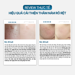Kem Dưỡng Dr.Melaxin TX Cream Dưỡng Sáng Da, Mờ Vết Nám Tàn Nhang 50g