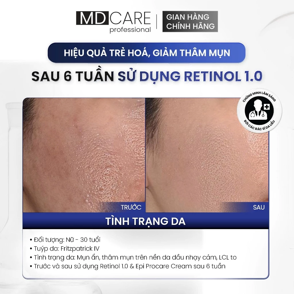 Kem Dưỡng MD Care Pro-Retinol Tái Tạo, Làm Sáng Và Cải Thiện Nếp Nhăn 30ml