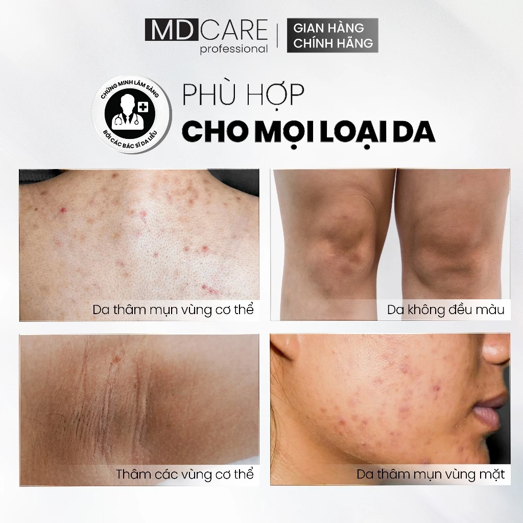 Kem Dưỡng Sáng Da MD CARE Brightening Blemish Cream 50ml