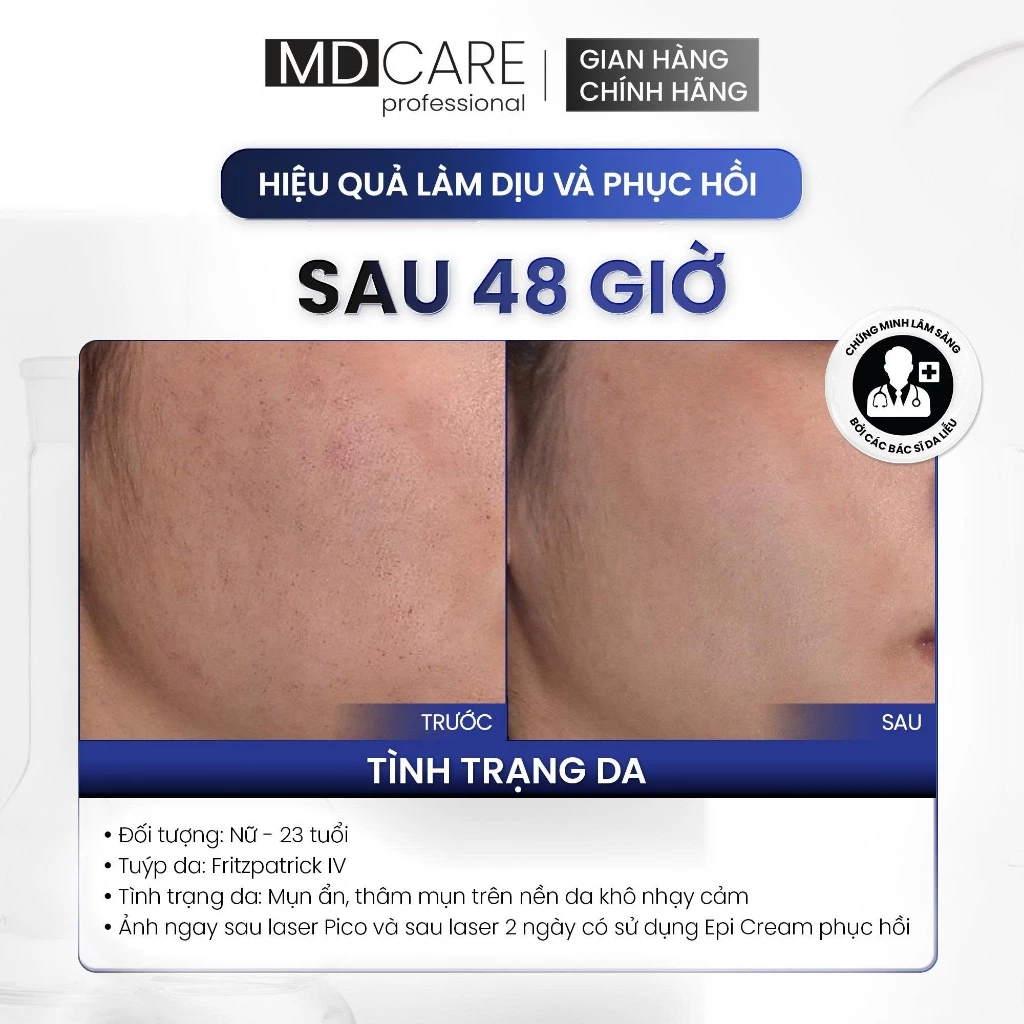 Kem Dưỡng MD Care Epi-ProCare Cream Phục Hồi Và Cải Thiện Nếp Nhăn 30ml