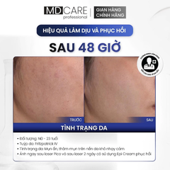 Kem Dưỡng MD Care Epi-ProCare Cream Phục Hồi Và Cải Thiện Nếp Nhăn 30ml