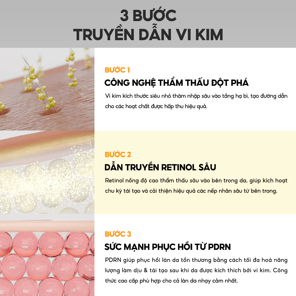 Kem Dưỡng Vi Kim MARY&MAY Cream 15g