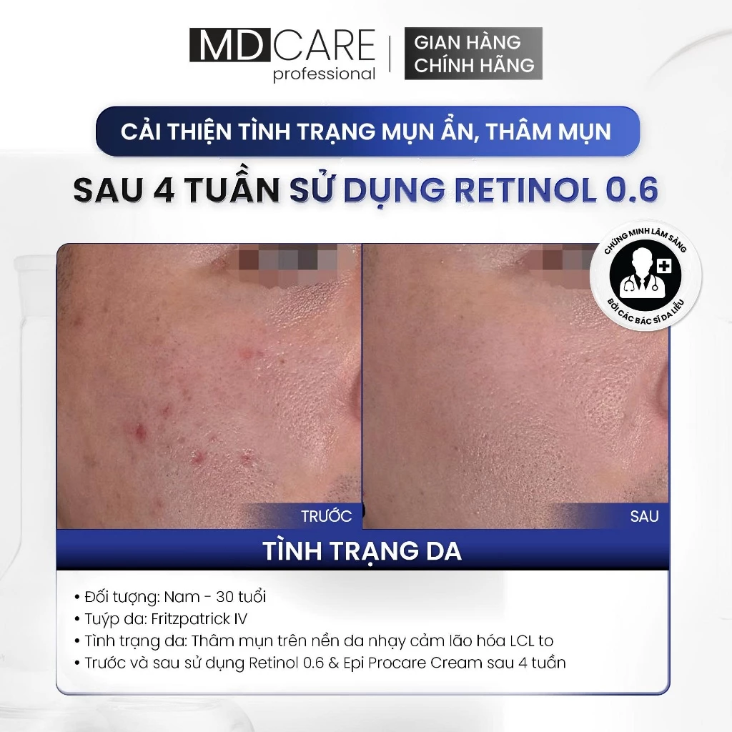 Kem Dưỡng MD Care Pro-Retinol Tái Tạo, Làm Sáng Và Cải Thiện Nếp Nhăn 30ml