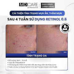 Kem Dưỡng MD Care Pro-Retinol Tái Tạo, Làm Sáng Và Cải Thiện Nếp Nhăn 30ml