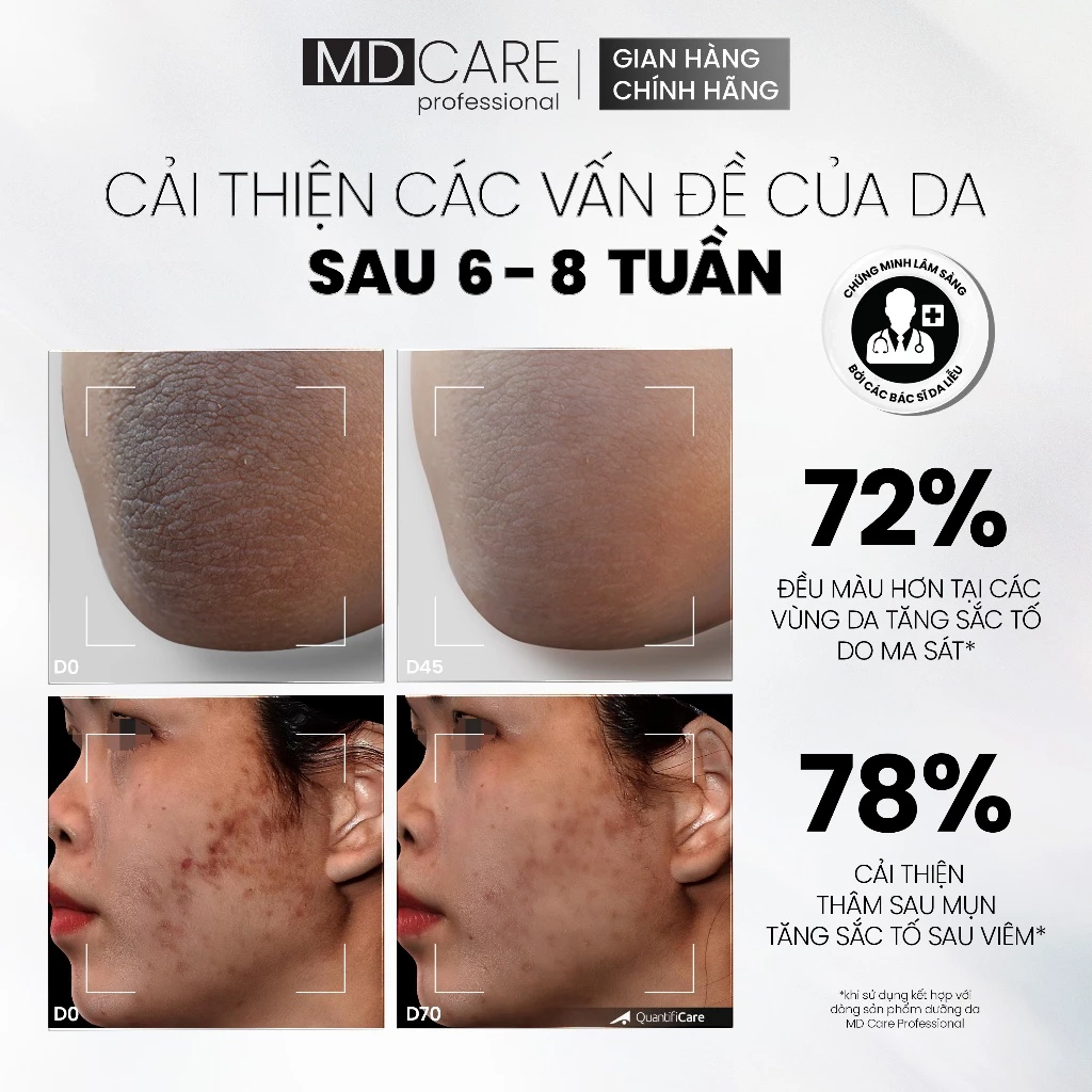 Kem Dưỡng Sáng Da MD CARE Brightening Blemish Cream 50ml