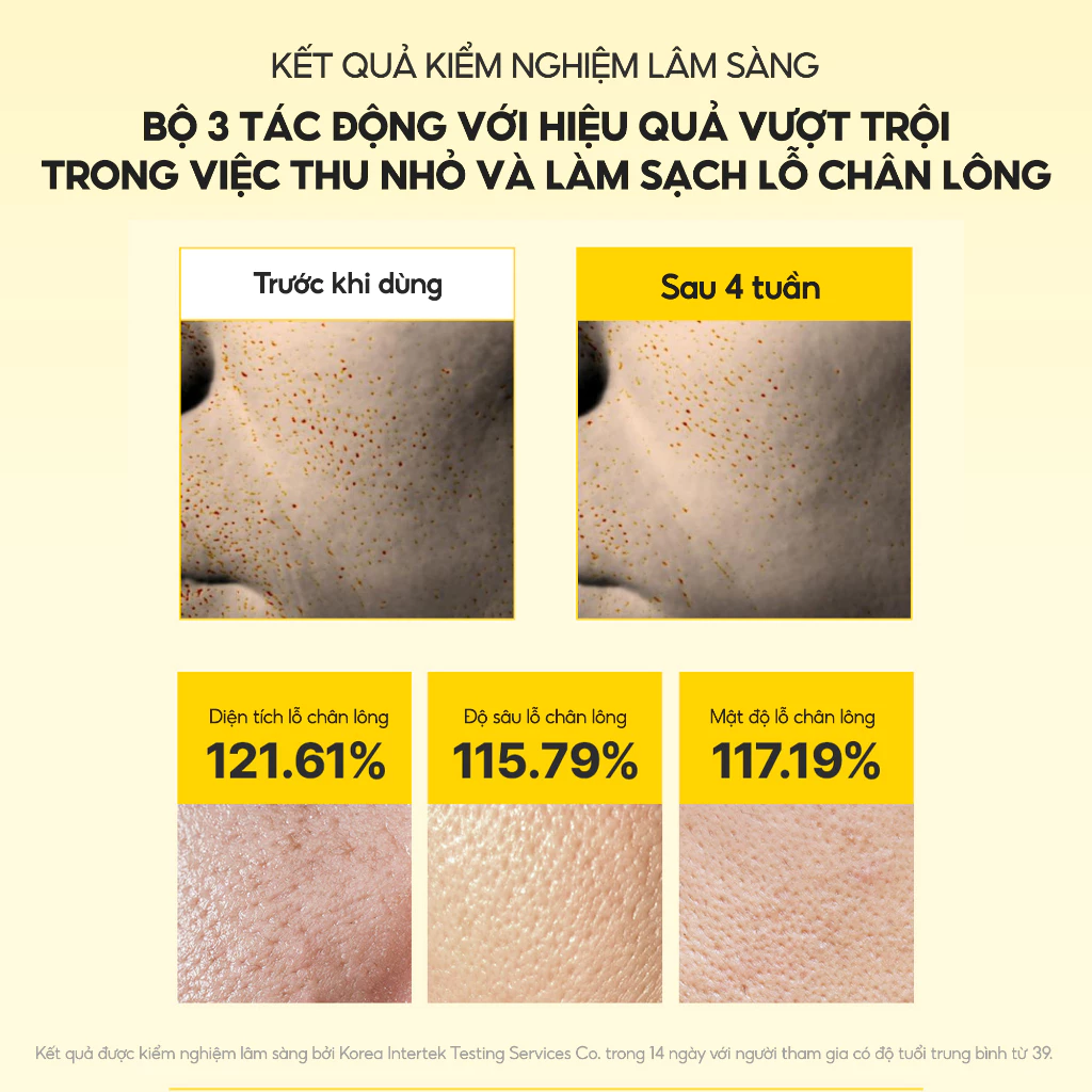 Kem Dưỡng Vi Kim MARY&MAY Cream 15g