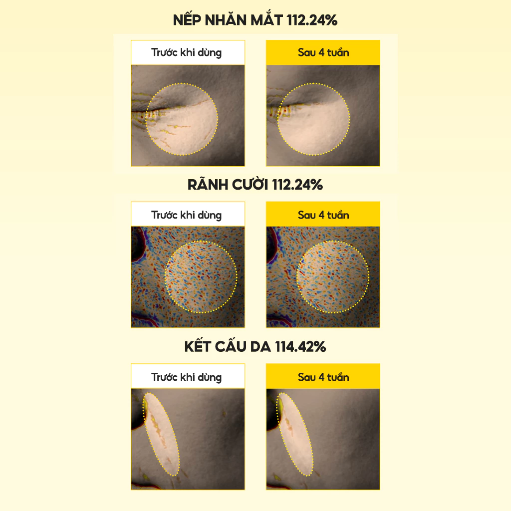 Kem Dưỡng Vi Kim MARY&MAY Cream 15g