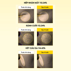Kem Dưỡng Vi Kim MARY&MAY Cream 15g