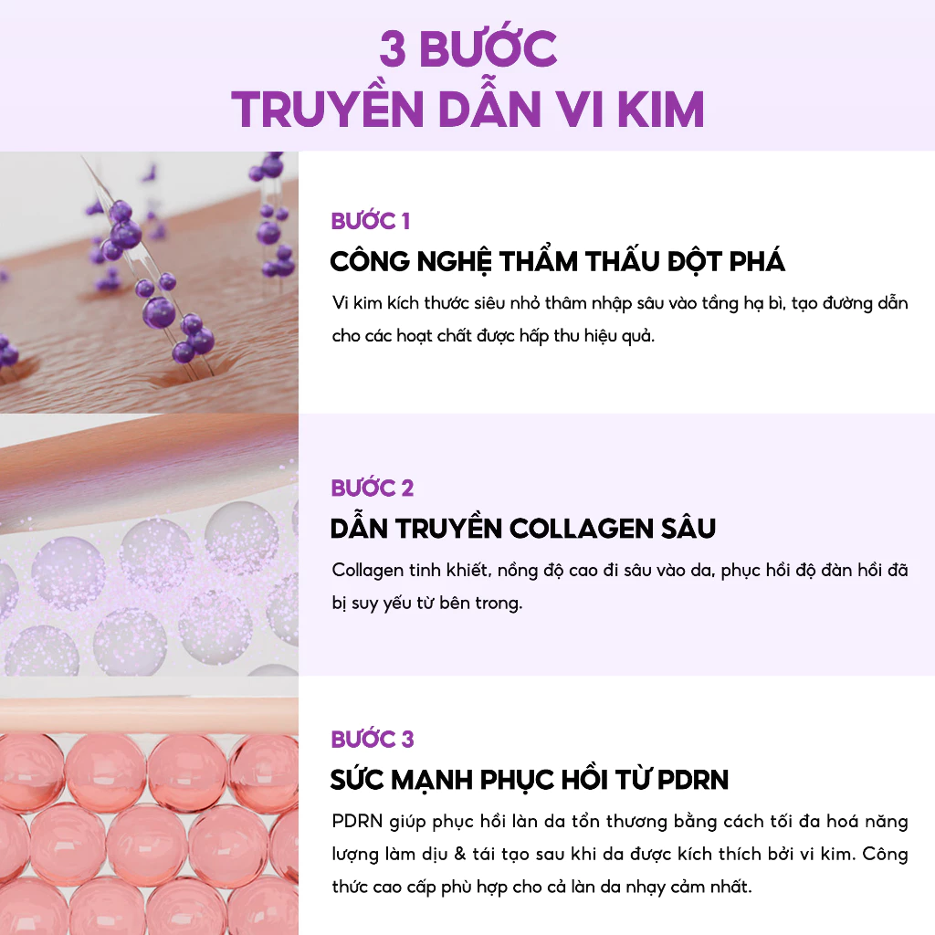 Kem Dưỡng Vi Kim MARY&MAY Cream 15g