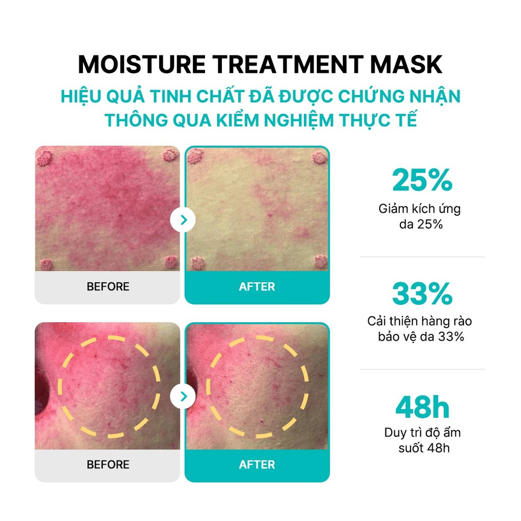 Mặt Nạ Rejuran Moisture Treatment Mask Dưỡng Ẩm Làm Dịu Da 23ml