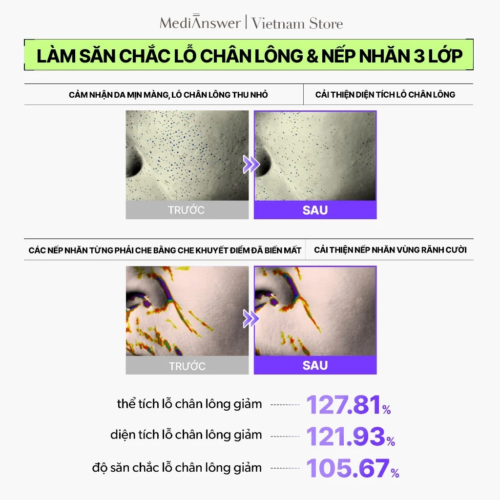 Mặt Nạ Thạch MediAnswer Retinoid Liftxyl Mask Nâng Cơ, Đàn Hồi & Săn Chắc Da 43g