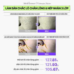 Mặt Nạ Thạch MediAnswer Retinoid Liftxyl Mask Nâng Cơ, Đàn Hồi & Săn Chắc Da 43g