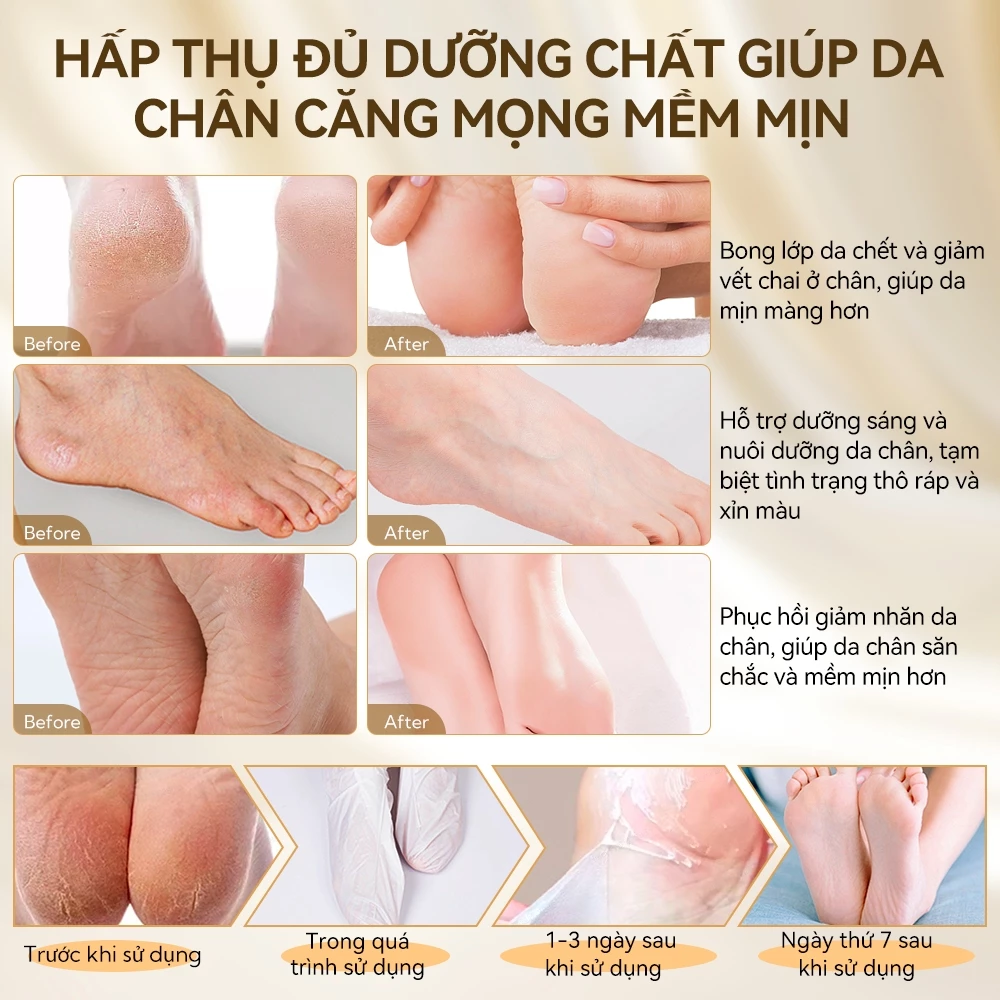 Mặt Nạ Da Chân Lanbena Foot Peel Mask Remove Calluses Làm Sạch Tế Bào Chết 40g/Đôi