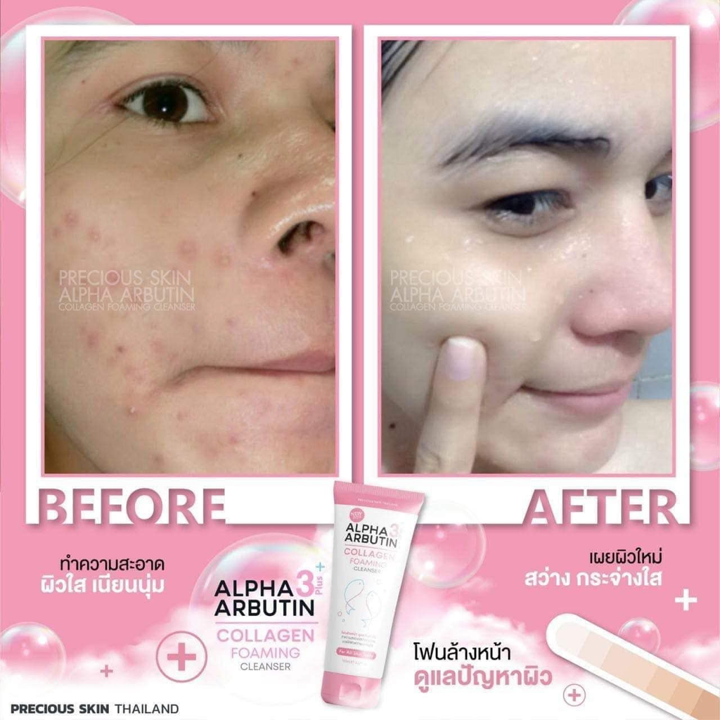 Sữa Rửa Mặt Trắng Da Precious Skin Alpha Arbutin 3 Plus Collagen Foaming Cleanser 120g