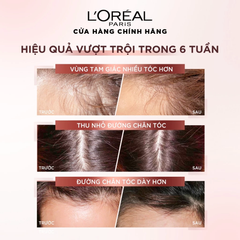 Serum Xịt Dưỡng Tóc L'Oreal Full Resist Anti Hairfall Ngăn Ngừa & Giảm Gãy Rụng 90ml