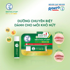 Son Dưỡng Mentholatum Medi Lip Stick Chuyên Biệt Cho Môi Khô, Nứt Nẻ 4.3g