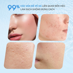 Nước Tẩy Trang Melomeli B5 Hyaluronic Acid Cleansing Water Làm Sạch Sâu Cấp Ẩm Và Làm Dịu Da