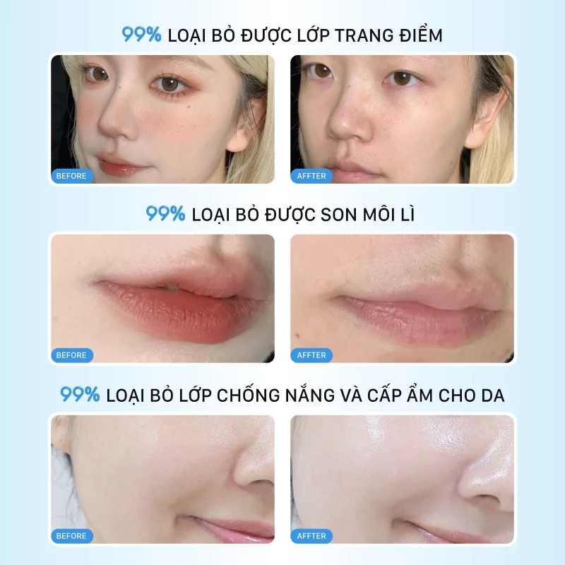 Nước Tẩy Trang Melomeli B5 Hyaluronic Acid Cleansing Water Làm Sạch Sâu Cấp Ẩm Và Làm Dịu Da
