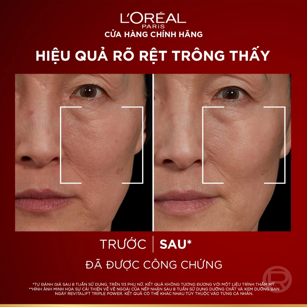 Tinh Chất L'Oreal Paris Revitalift Triple Power Age-Correcting Serum Giảm Nếp Nhăn, Ngừa Lão Hóa 30ml