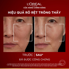 Tinh Chất L'Oreal Paris Revitalift Triple Power Age-Correcting Serum Giảm Nếp Nhăn, Ngừa Lão Hóa 30ml