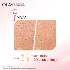 Tinh Chất Olay Regenerist Ultra Firming Serum Săn Chắc Da, Chống Lão Hóa Chuyên Sâu 30ml