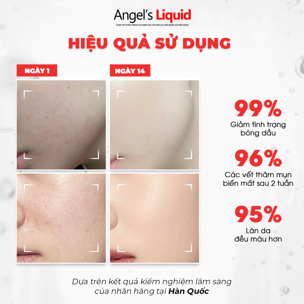 Serum Dưỡng Trắng Angel’s Liquid Glutathione Plus Niacinamide Cica Kiểm Soát Dầu, Thu Nhỏ Lỗ Chân Lông 45ml