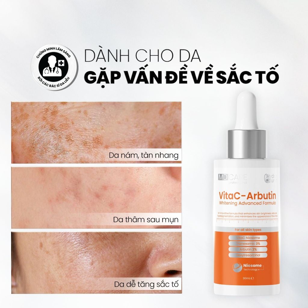 Tinh Chất MD CARE VitaC Arbutin Serum Sáng Da, Chống Lão Hóa 30ml