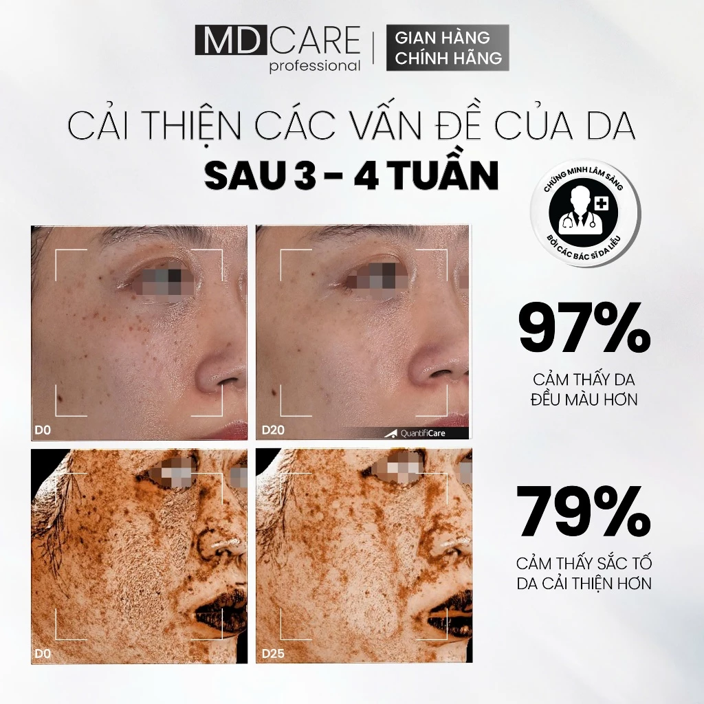 Tinh Chất MD CARE VitaC Arbutin Serum Sáng Da, Chống Lão Hóa 30ml