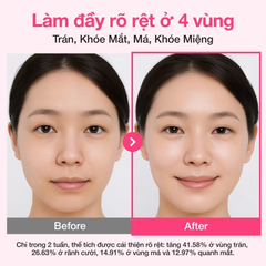 Tinh Chất Numbuzin NO.2 Rose PDRN Collagen Plumping Serum 30ml