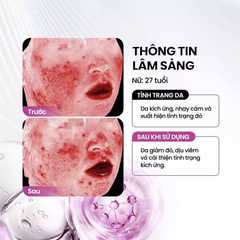 Tinh Chất MD Care Peptide Bioactiv Matrix Serum Phục Hồi và Giảm Đỏ 30ml