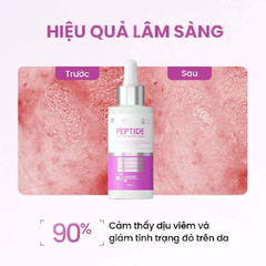 Tinh Chất MD Care Peptide Bioactiv Matrix Serum Phục Hồi và Giảm Đỏ 30ml