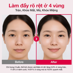 Tinh Chất Numbuzin NO.2 Rose PDRN Collagen Plumping Serum 30ml