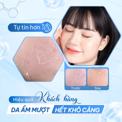 Xịt Khoáng Compliment Cooling Aqua Spray 99% Giúp Cấp Nước, Kiềm Dầu Làm Dịu Da 200ml