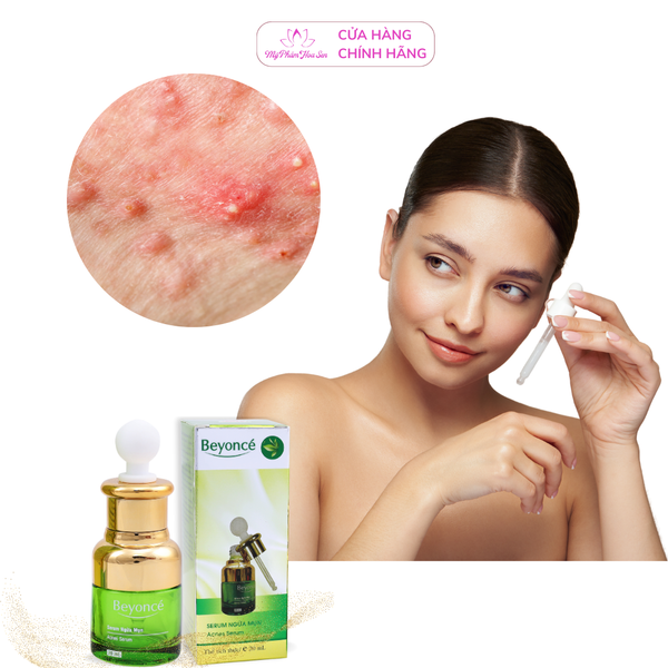 [BEYONCÉ] Serum Dưỡng ẩm, Ngừa mụn